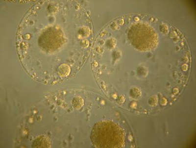 Encapsulation d'hepatocytes
