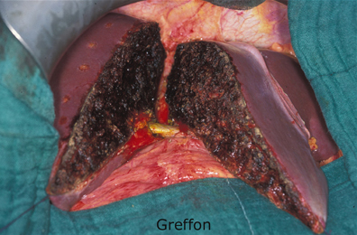 greffon