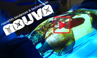 La 3D révolutionne la médecine nouvo_news_art