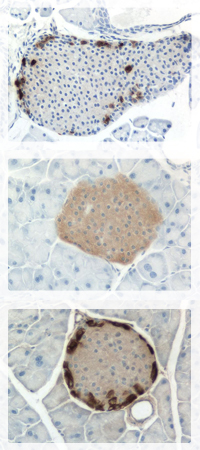 pancreatic_islets