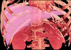 liver